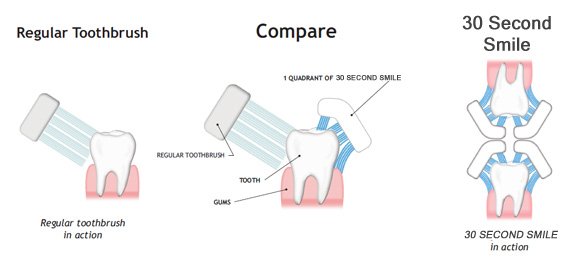 Regular Toothbrush vs 30 Second Smile Review
