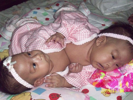 Angelica and Angelina in the Philippines at 3 months old